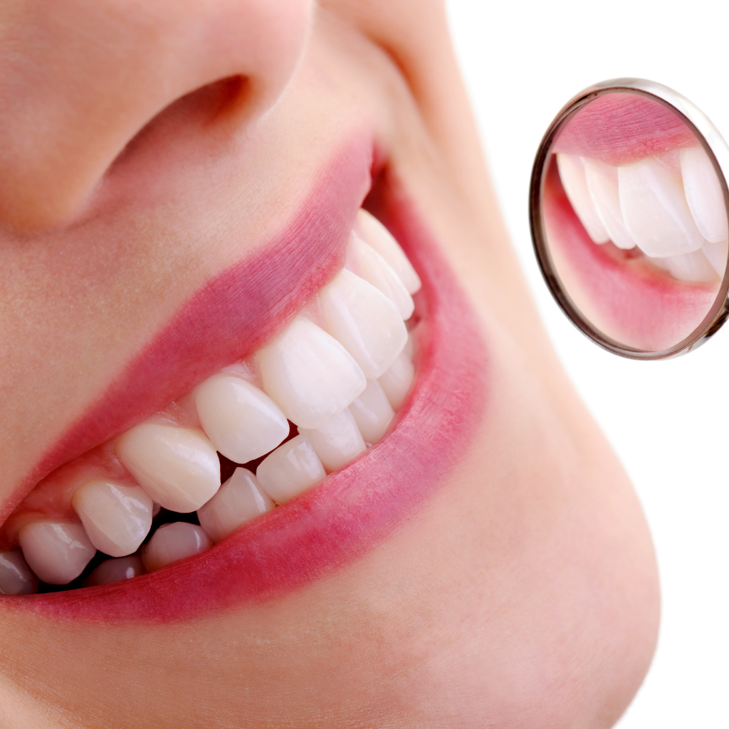 Hollywood Smile Tedavisi Süreçleri